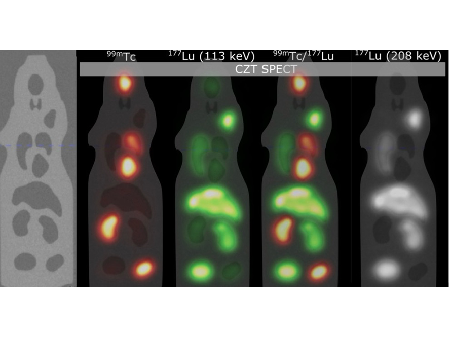 Series of multi gamma-ray CZT (Single Photon Emission Computed Tomography) scans.