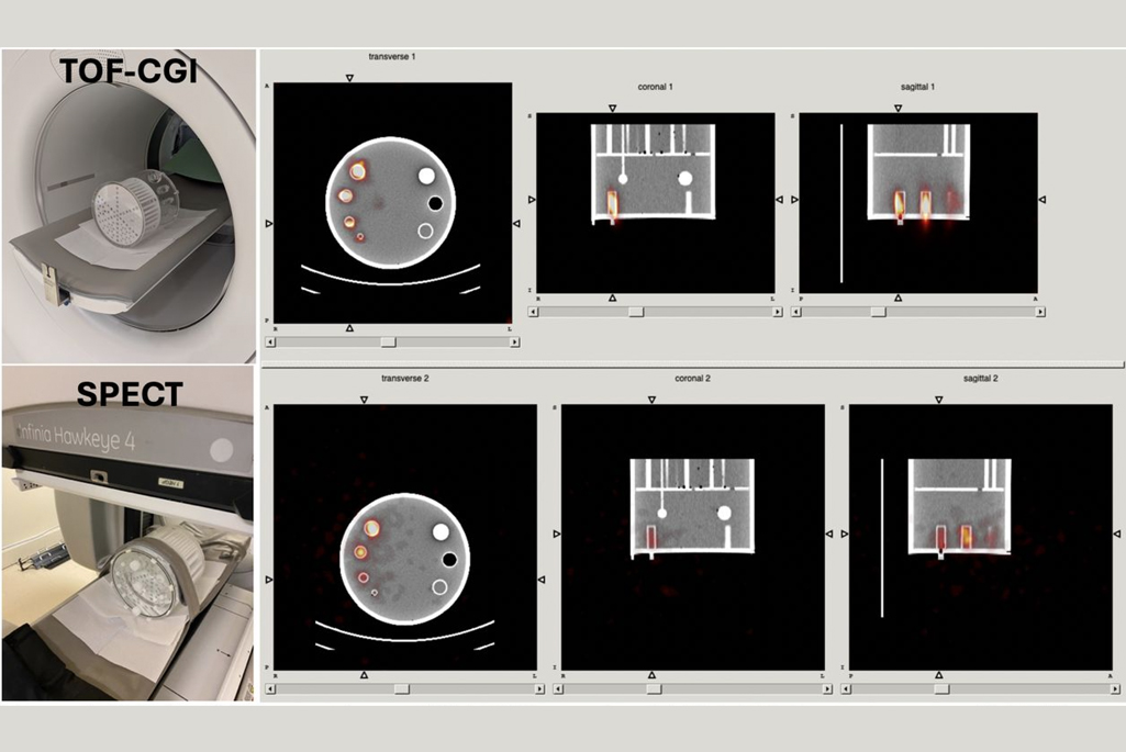 Side-by-side comparison of TOF-CGI image in a SIEMENS Vision scanner vs a SPECT image in a GE Hawkeye 4. The TOF-CGI images show much lower noise, which is reflected in superior SNR with respect to SPECT.