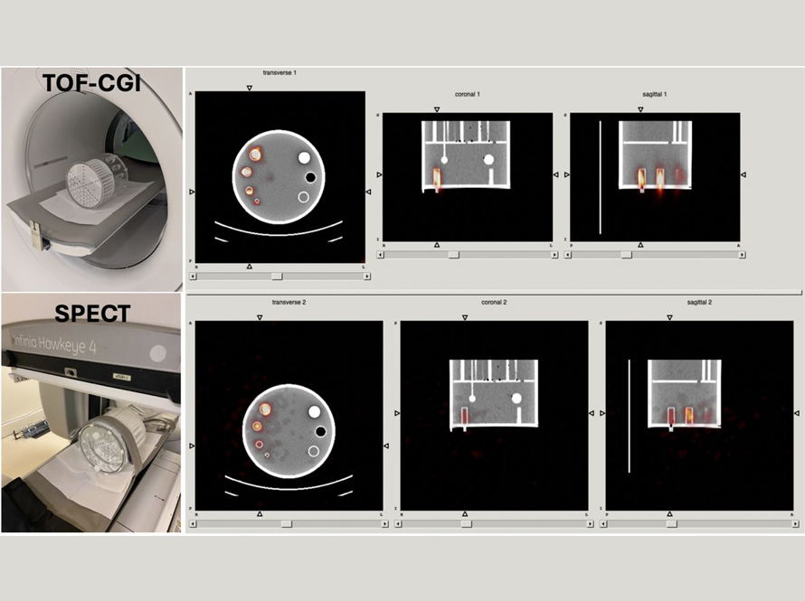 Side-by-side comparison of TOF-CGI image in a SIEMENS Vision scanner vs a SPECT image in a GE Hawkeye 4. The TOF-CGI images show much lower noise, which is reflected in superior SNR with respect to SPECT.